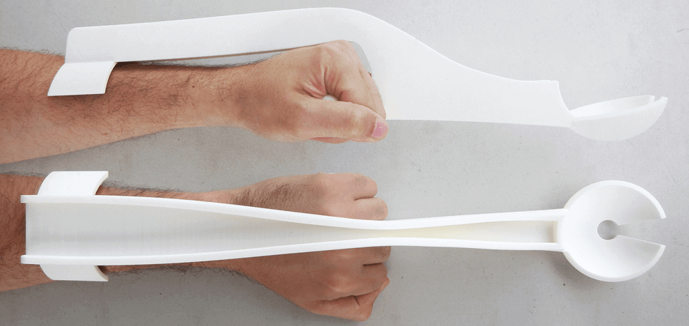 use-3d-printed-abdominal-compression-device-facilitate-ct-fluoroscopy-guided-percutaneous-interventions-2 use-3d-printed-abdominal-compression-device-facilitate-ct-fluoroscopy-guided-percutaneous-interventions-2